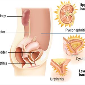 Tests For Chronic Uti Bloggers - Learning About The Prostate Gland