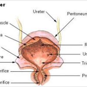 How To Prevent Uti Infection 