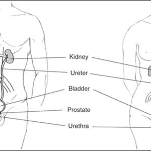 Home Remedy For Urinary Tract Infection - Home Relief For Urinary Tract Infections - Take The Confusion Out Of Home Remedies