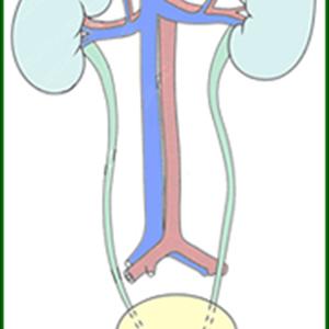 Strong Smelling Urine Tips - What Is Irritable Bladder