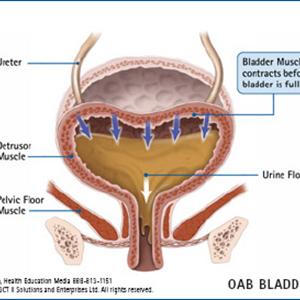 Uti Infection Causes - Different Stages Of Kidney Infections