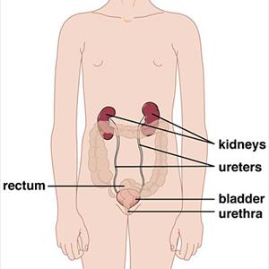 Bladder Pain - Bactrim- Urinary Tract Disease Cure