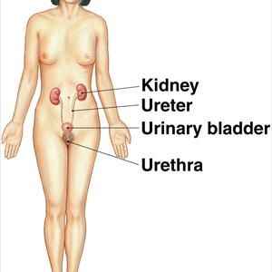 Cloudy Urine - UTI Remedy - Cure Urinary Infection With A Piece Of Fruit