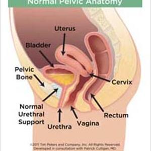  A Simple Guide For A Urinary Infection Home Treatment