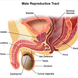 Chronic Infection Male Tract Urinary - Treatment Of UTI - Natural Vs Traditional